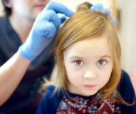 Kutu Rambut? No Way! Tips Efektif Menjaga Rambut Anak Tetap Bersih dan Sehat